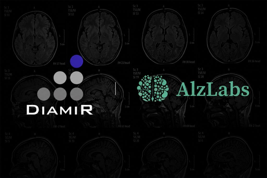 Aptorum-backed DiamiR expands Alzheimer’s diagnostic efforts