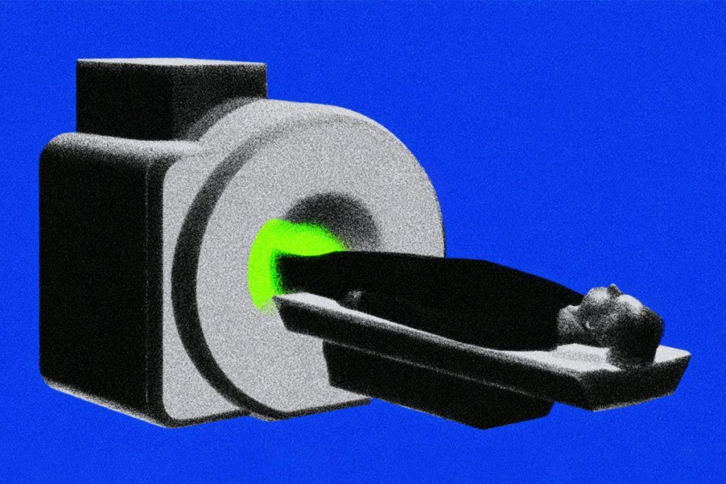 Whole-body MRI is leaving the biohacker bubble