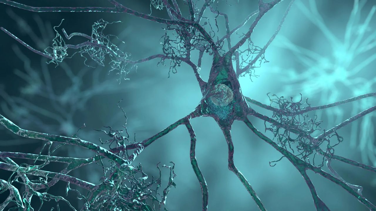 A major Alzheimer’s risk gene may shrink brain cells years before symptoms