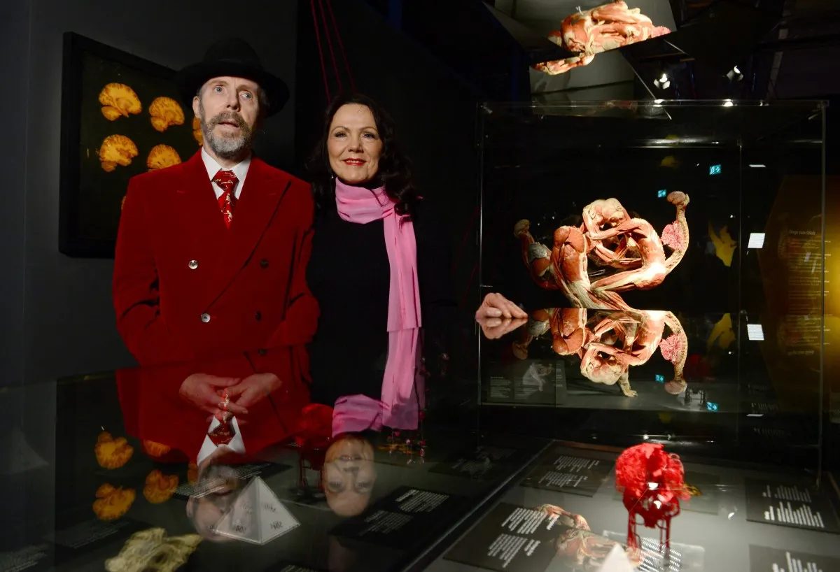 German creator of 'Body Worlds' anatomy exhibits dies at 81