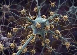 In ALS, Microglia Eat Living Neurons, Mistaking Them for Dead
